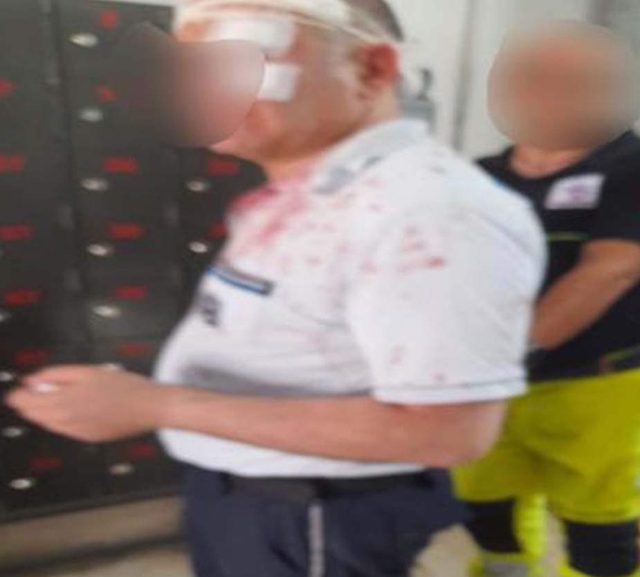 carcere di taranto agente penitenziario aggredito da detenuto per reati di mafia oggi da Noinotizie.it carcere di taranto agente penitenziario aggredito da detenuto per reati di mafia oggi